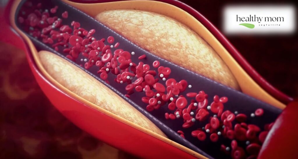 Understanding Cholesterol